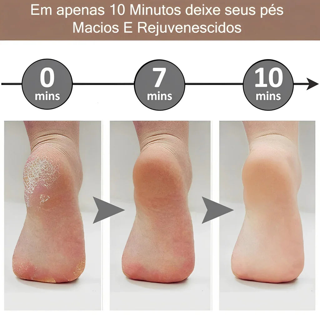 Lixador de Pé Elétrico